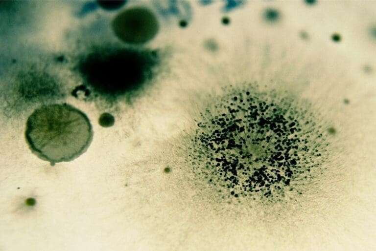 mold picture taken by microscope